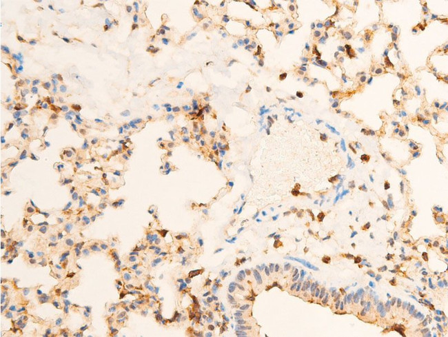 Phospho-TrkA (Tyr680, Tyr681) Antibody in Immunohistochemistry (Paraffin) (IHC (P))