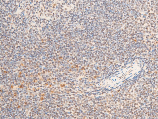 Phospho-TrkA (Tyr680, Tyr681) Antibody in Immunohistochemistry (Paraffin) (IHC (P))