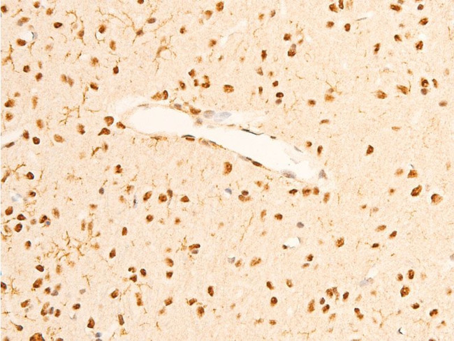 Phospho-TrkA (Tyr680, Tyr681) Antibody in Immunohistochemistry (Paraffin) (IHC (P))