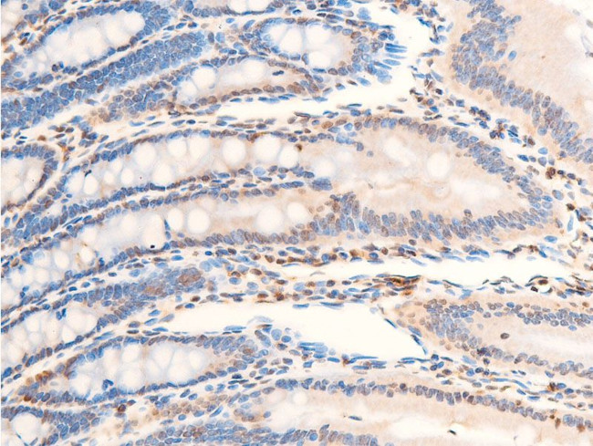 Phospho-TrkA (Tyr680, Tyr681) Antibody in Immunohistochemistry (Paraffin) (IHC (P))