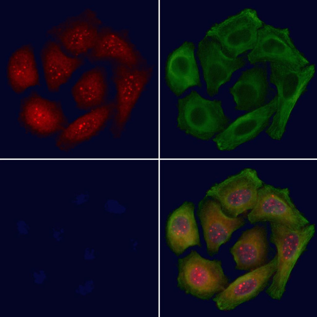 Phospho-p53 (Ser20) Antibody in Immunocytochemistry (ICC/IF)