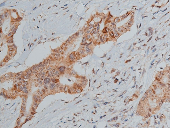 Phospho-p53 (Ser20) Antibody in Immunohistochemistry (Paraffin) (IHC (P))