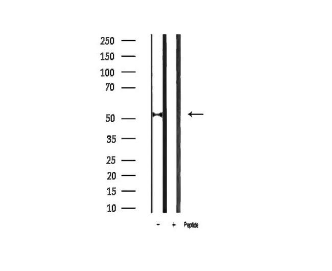 Phospho-p53 (Ser20) Antibody in Western Blot (WB)