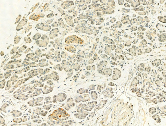 Phospho-p53 (Ser15) Antibody in Immunohistochemistry (Paraffin) (IHC (P))