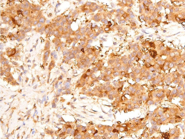 Phospho-p53 (Ser15) Antibody in Immunohistochemistry (Paraffin) (IHC (P))