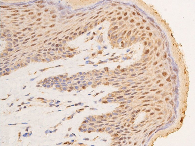 Phospho-p53 (Ser15) Antibody in Immunohistochemistry (Paraffin) (IHC (P))