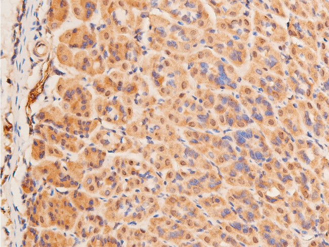 Phospho-p53 (Ser15) Antibody in Immunohistochemistry (Paraffin) (IHC (P))