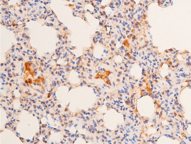 Phospho-p53 (Ser15) Antibody in Immunohistochemistry (Paraffin) (IHC (P))