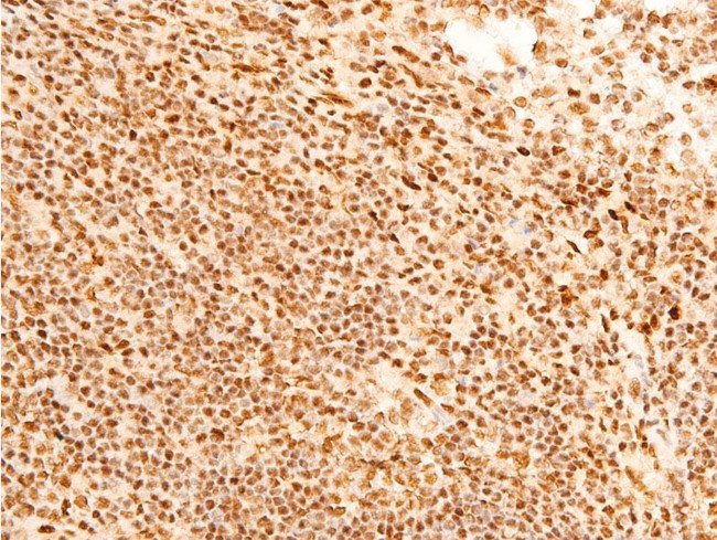 Phospho-c-Jun (Ser243) Antibody in Immunohistochemistry (Paraffin) (IHC (P))