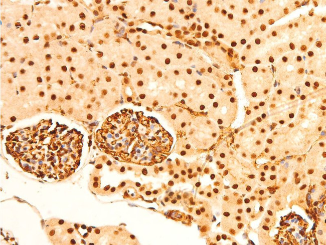 Phospho-c-Jun (Ser243) Antibody in Immunohistochemistry (Paraffin) (IHC (P))