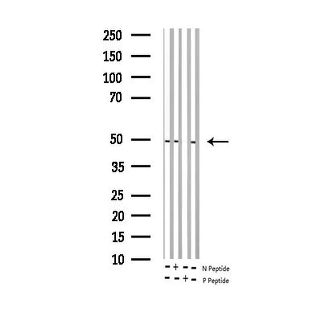 Phospho-c-Jun (Ser243) Antibody in Western Blot (WB)