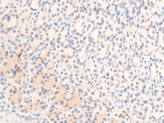 Phospho-c-Jun (Thr239) Antibody in Immunohistochemistry (Paraffin) (IHC (P))