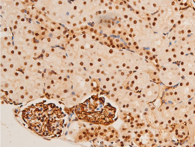 Phospho-c-Jun (Thr91) Antibody in Immunohistochemistry (Paraffin) (IHC (P))