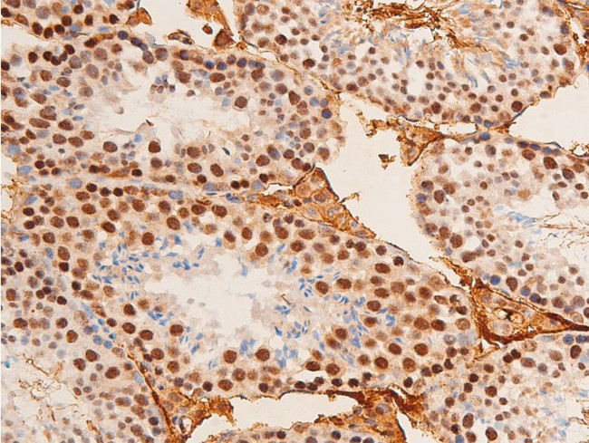 Phospho-c-Jun (Thr91) Antibody in Immunohistochemistry (Paraffin) (IHC (P))