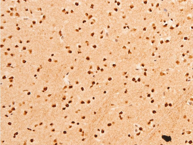 Phospho-c-Jun (Thr91) Antibody in Immunohistochemistry (Paraffin) (IHC (P))