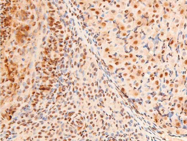 Phospho-c-Jun (Thr91) Antibody in Immunohistochemistry (Paraffin) (IHC (P))