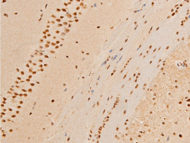 Phospho-c-Jun (Thr93) Antibody in Immunohistochemistry (Paraffin) (IHC (P))