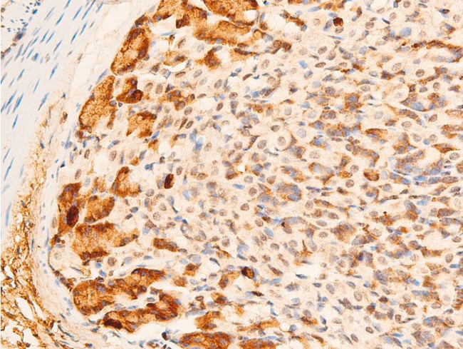 Phospho-c-Jun (Tyr170) Antibody in Immunohistochemistry (Paraffin) (IHC (P))