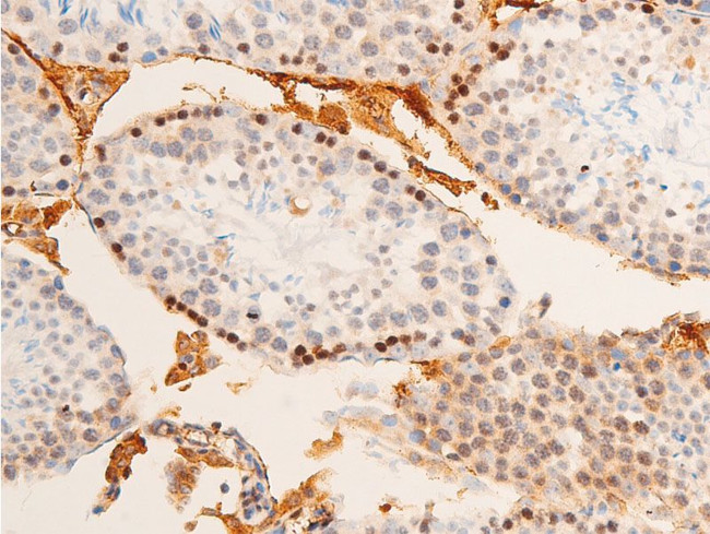 Phospho-c-Jun (Tyr170) Antibody in Immunohistochemistry (Paraffin) (IHC (P))