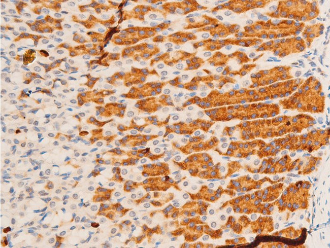 Phospho-c-Jun (Tyr170) Antibody in Immunohistochemistry (Paraffin) (IHC (P))