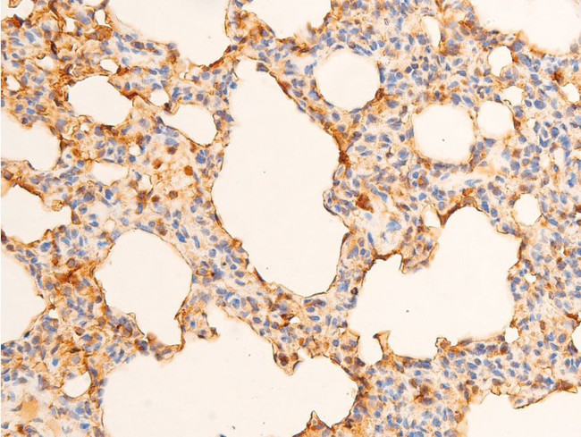 Phospho-c-Jun (Tyr170) Antibody in Immunohistochemistry (Paraffin) (IHC (P))