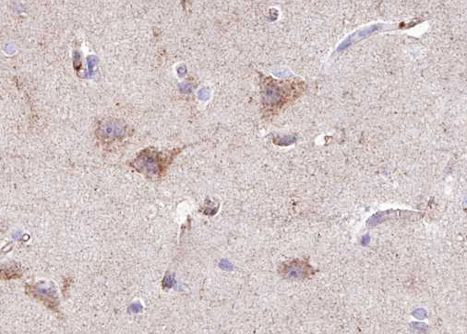 Phospho-INSR (Tyr1355) Antibody in Immunohistochemistry (Paraffin) (IHC (P))