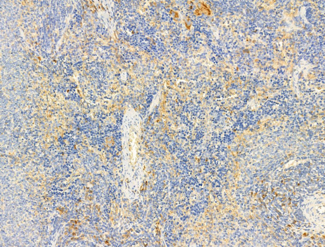 Phospho-Fyn (Tyr531) Antibody in Immunohistochemistry (Paraffin) (IHC (P))