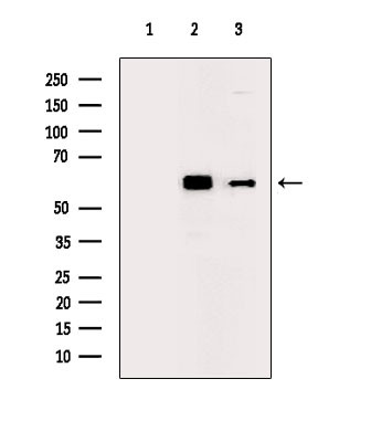 Phospho-Fyn (Tyr531) Antibody in Western Blot (WB)