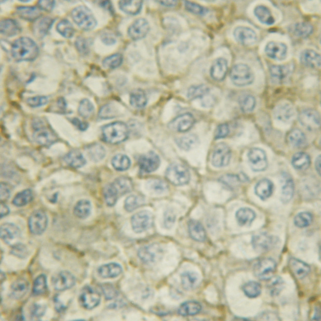 Phospho-Fyn (Tyr531) Antibody in Immunohistochemistry (Paraffin) (IHC (P))