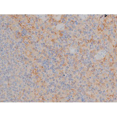 Phospho-Fyn (Tyr531) Antibody in Immunohistochemistry (Paraffin) (IHC (P))