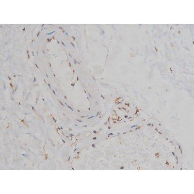 Phospho-Fyn (Tyr531) Antibody in Immunohistochemistry (Paraffin) (IHC (P))