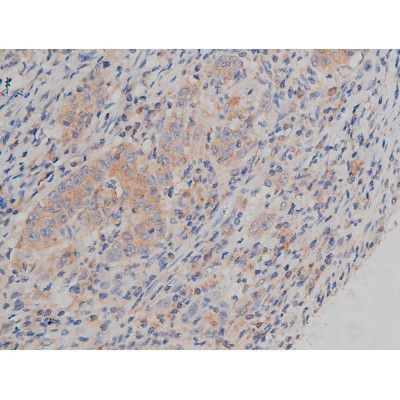 Phospho-Fyn (Tyr531) Antibody in Immunohistochemistry (Paraffin) (IHC (P))