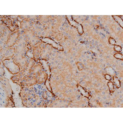 Phospho-Fyn (Tyr531) Antibody in Immunohistochemistry (Paraffin) (IHC (P))