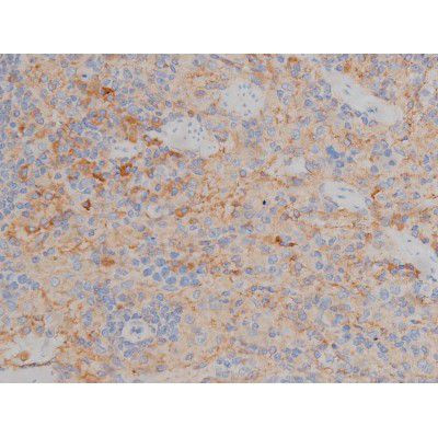 Phospho-Fyn (Tyr531) Antibody in Immunohistochemistry (Paraffin) (IHC (P))