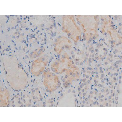 Phospho-Fyn (Tyr531) Antibody in Immunohistochemistry (Paraffin) (IHC (P))