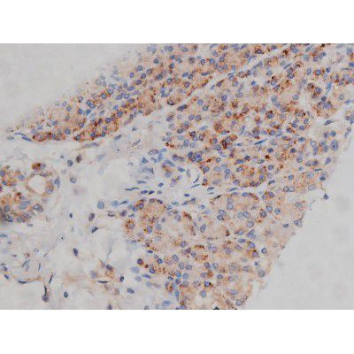 Phospho-Fyn (Tyr531) Antibody in Immunohistochemistry (Paraffin) (IHC (P))