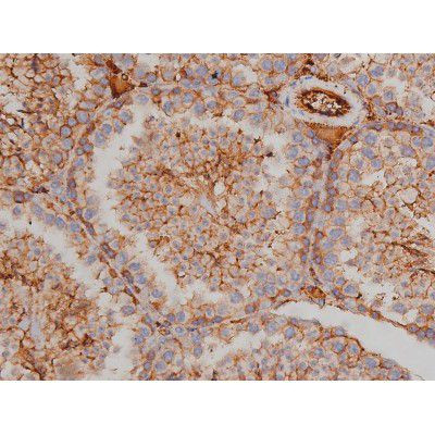 Phospho-Fyn (Tyr531) Antibody in Immunohistochemistry (Paraffin) (IHC (P))