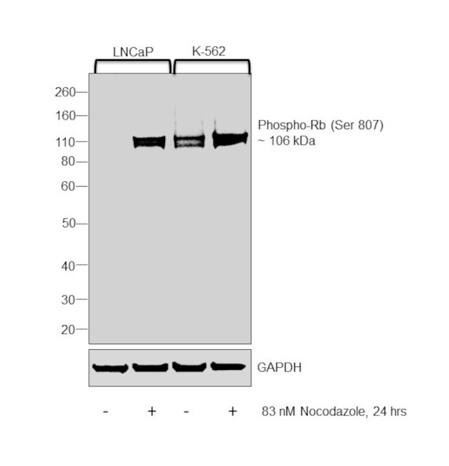 Phospho-Rb (Ser807) Antibody in Western Blot (WB)