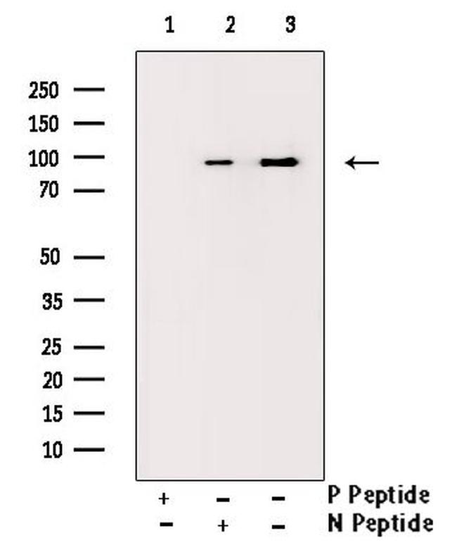 Phospho-Progesterone Receptor (Ser294) Antibody in Western Blot (WB)