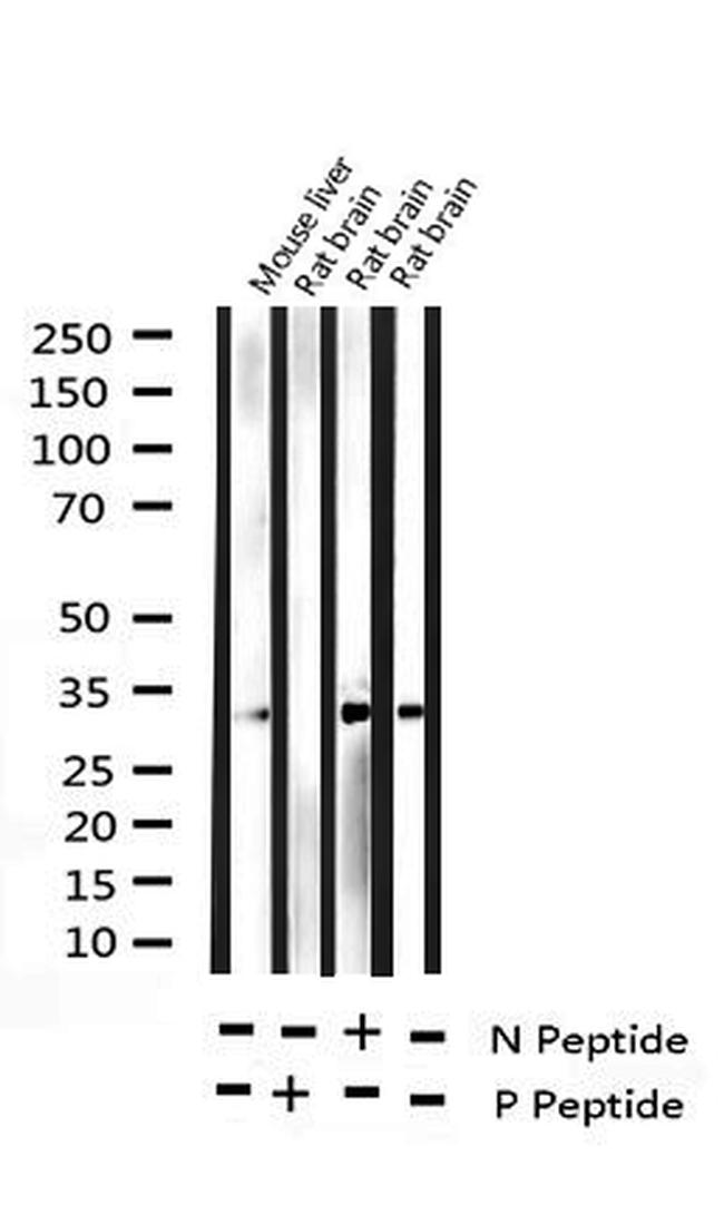 Phospho-NPM1 (Thr199) Antibody in Western Blot (WB)
