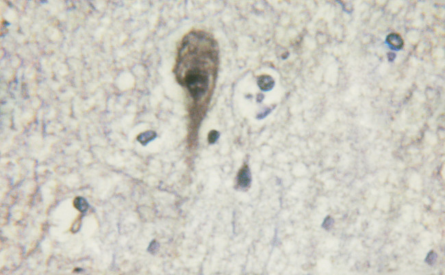 Phospho-beta-2 Adrenergic Receptor (Ser346) Antibody in Immunohistochemistry (Paraffin) (IHC (P))