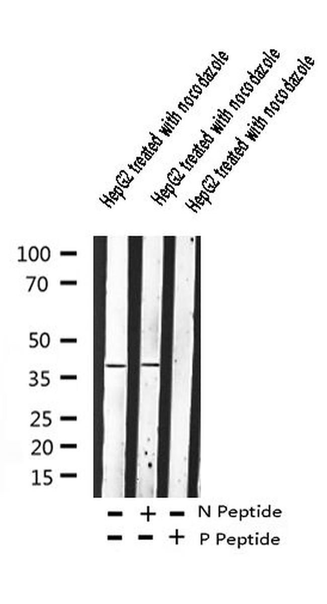 Phospho-beta-2 Adrenergic Receptor (Ser346) Antibody in Western Blot (WB)