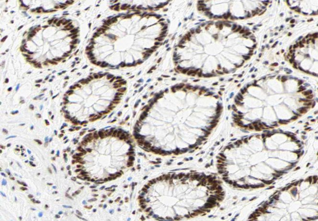 Phospho-hnRNP C (Ser260) Antibody in Immunohistochemistry (Paraffin) (IHC (P))