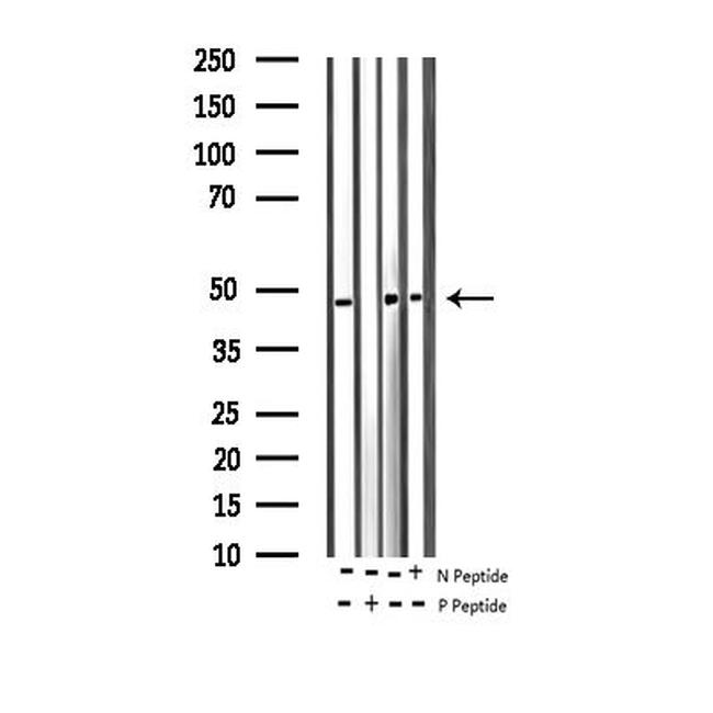 Phospho-hnRNP C (Ser260) Antibody in Western Blot (WB)