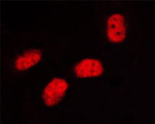 Phospho-SP1 (Thr453) Antibody in Immunocytochemistry (ICC/IF)