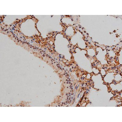 Phospho-SP1 (Thr453) Antibody in Immunohistochemistry (Paraffin) (IHC (P))