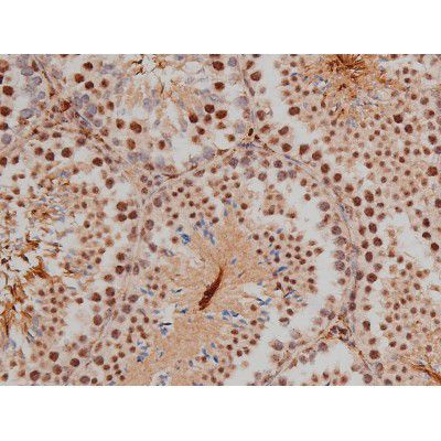 Phospho-SP1 (Thr453) Antibody in Immunohistochemistry (Paraffin) (IHC (P))