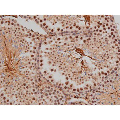 Phospho-SP1 (Thr453) Antibody in Immunohistochemistry (Paraffin) (IHC (P))