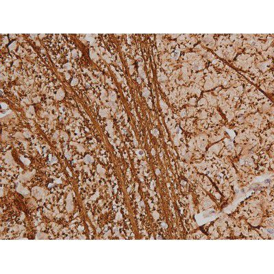 Phospho-SP1 (Thr453) Antibody in Immunohistochemistry (Paraffin) (IHC (P))