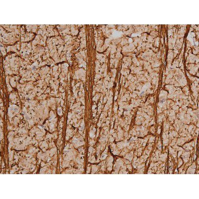 Phospho-SP1 (Thr453) Antibody in Immunohistochemistry (Paraffin) (IHC (P))